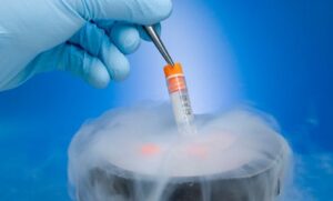 crioperservacion-de-semen